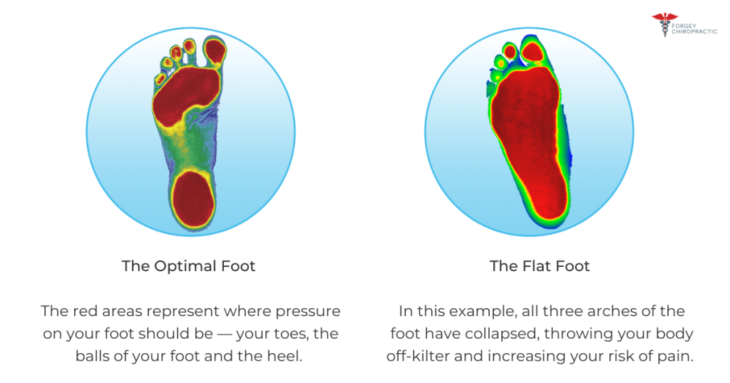 Custom Orthotics in Vancouver for Pain Relief Chiropractic in Vancouver WA